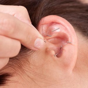 Curso Auriculoterapia